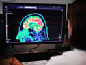 The research was conducted by scientists at the University of Edinburgh. 