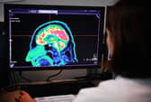 The research was conducted by scientists at the University of Edinburgh. 