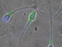 The new pill ‘stuns’ sperm, making them unable to swim to an egg.