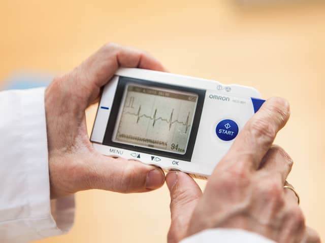 A link between oestrogen and heart arrhythmia in women has been found by researchers.