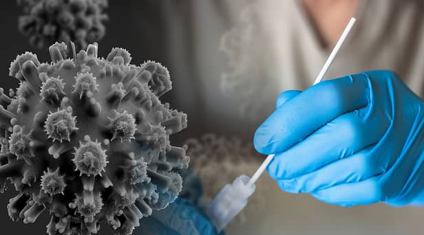 A new variant of Covid named Eris has emerged as figures show a spike in hospital admissions this summer