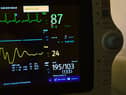 British Heart Foundation said the number of people with a heart rhythm condition has passed 1.5 million.