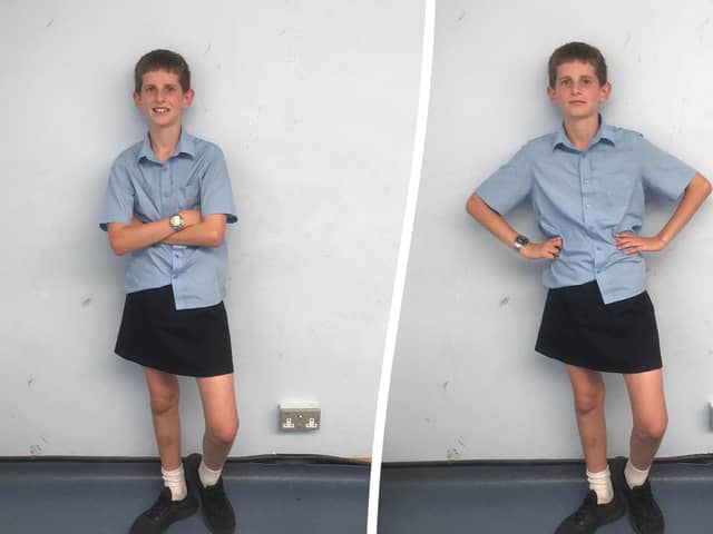 Toby has worn a skirt to school in protest of the school’s dress code which stops male students wearing shorts.  (SWNS)
