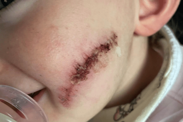 Specialists have told the family that due to Robyn's specific condition is so rare, she is the only person in the world to suffer from it. Photo: North News.