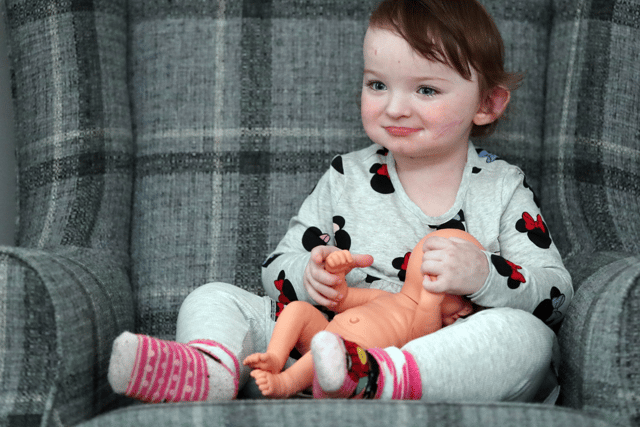Robyn Parker-Briggs suffers from Ehlers Danlos Syndrome (EDS), which causes her skin to bruise and burst open at the slightest of touches. Photo: North News.