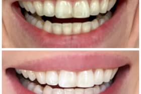 The MySweetSmile brand is one of the top players in this growing market