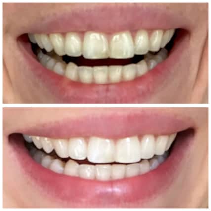 The MySweetSmile brand is one of the top players in this growing market