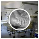 The WHO has declared a global health emergency over a mpox outbreak. (Photo: Pixabay, CDC/Getty Images)