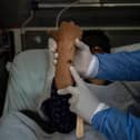 A doctor checks on a patient with sores caused by a mpox infection. (Photo: ERNESTO BENAVIDES/AFP via Getty Images)