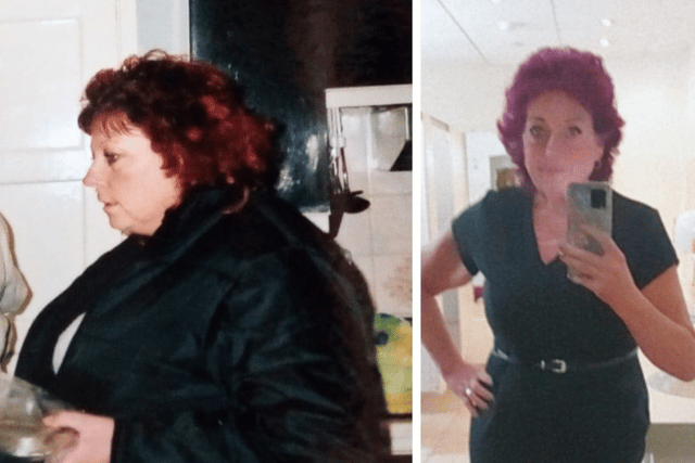 A before and after of Alison’s weight loss.