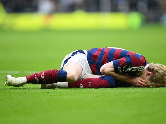 Anthony Gordon took a blow to the face against Spurs.