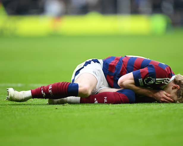 Anthony Gordon took a blow to the face against Spurs.
