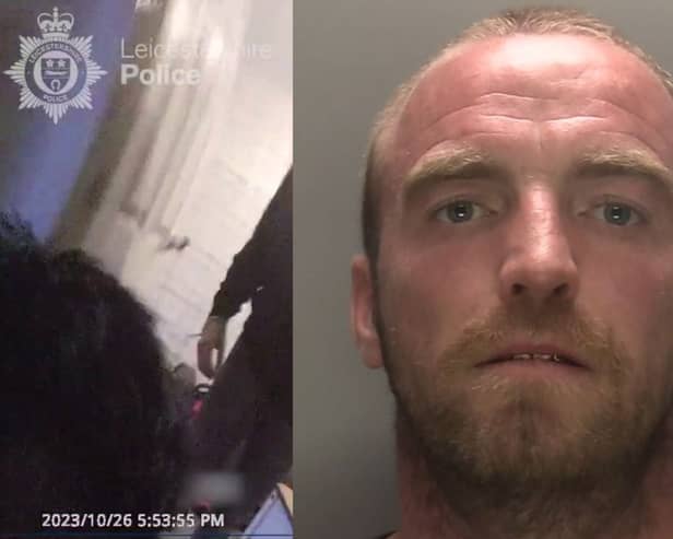 XL bully attacks police officer leaving him needing surgery.