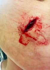 Shelly Wilson was left deeply shaken after she was stabbed in the face by a man on a bicycle in the Campbell Park area of Jarrow on Tuesday, March 4