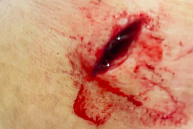 Shelly Wilson was left deeply shaken after she was stabbed in the face by a man on a bicycle in the Campbell Park area of Jarrow on Tuesday, March 4