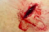 Shelly Wilson was left deeply shaken after she was stabbed in the face by a man on a bicycle in the Campbell Park area of Jarrow on Tuesday, March 4