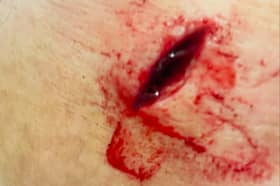 Shelly Wilson was left deeply shaken after she was stabbed in the face by a man on a bicycle in the Campbell Park area of Jarrow on Tuesday, March 4