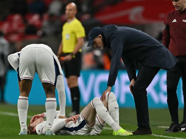 Anthony Gordon suffered an injury during England's clash with Albania.