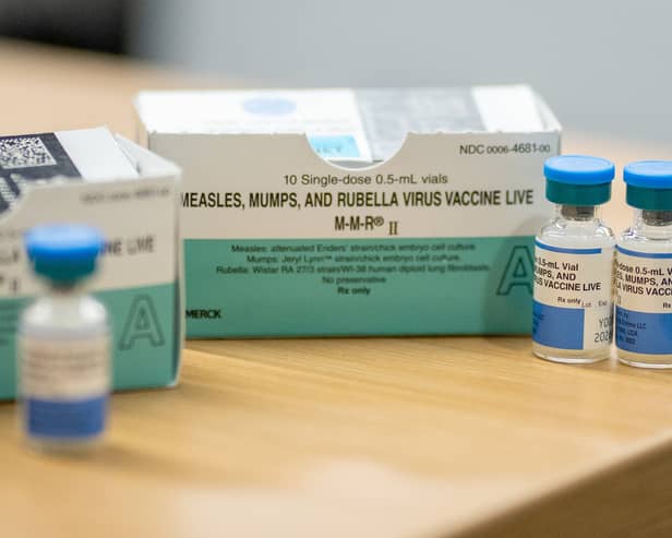 Measles is a highly contagious viral infection, which can have serious health consequences.