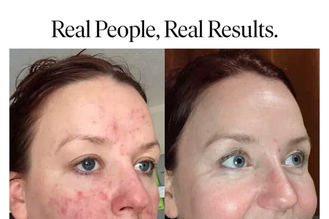 Customer results 47 Skin