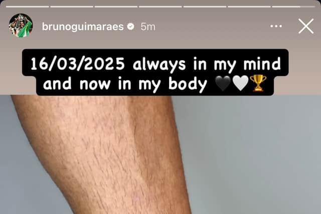 Bruno Guimaraes' tattoo.