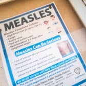 Measles is a highly contagious viral infection.
