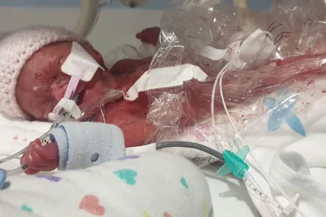 Charlotte Smith was given 'no chance' of survival when she was born at 23 weeks.