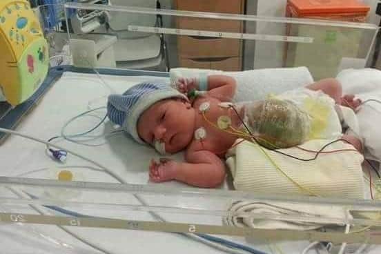 Jack in hospital when he was a baby.