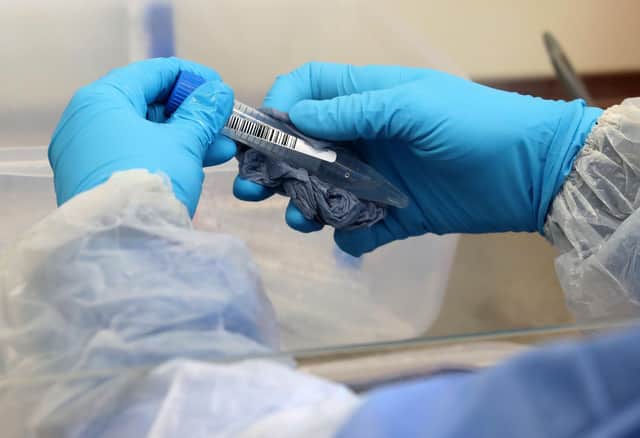 A laboratory technician wearing full PPE cleans a test tube containing a live sample taken from people tested for the novel coronavirus (Photo by Andrew Milligan / POOL / AFP)