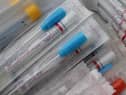 Surge testing is being used in Stockton after the South African variant of Covid-19 was found in the area.