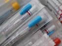 Surge testing is being used in Stockton after the South African variant of Covid-19 was found in the area.