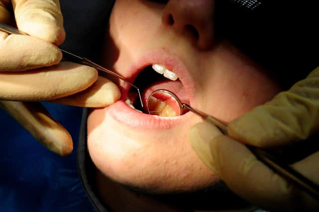 Child tooth extractions increase.