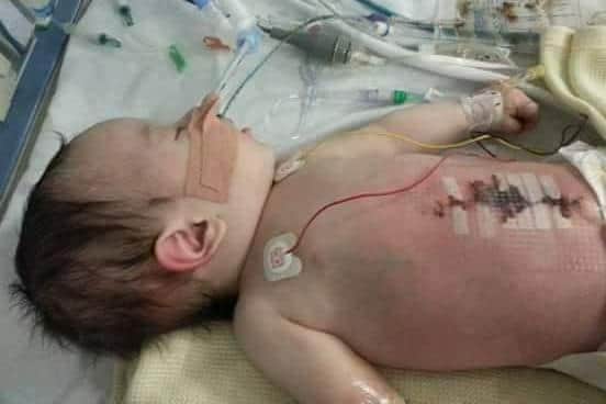 Brave Jack has battled for health ever since he was born.