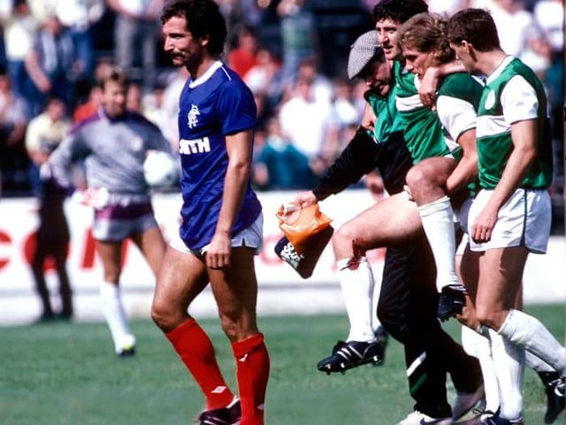 Graeme Souness: The lowest point of his career, he has admitted, was when he trudged off the field at Easter Road, red-carded on his first start as player-manager of Rangers for a horror tackle on George McCluskey. Souness didn't do too badly at Ibrox though.