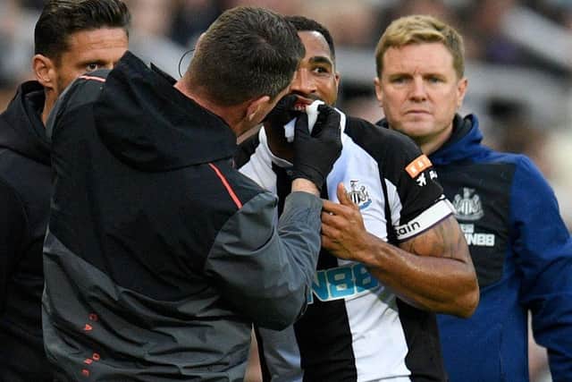 Newcastle United's English head coach Eddie Howe (R) watches as Newcastle United's English striker Callum Wilson receives treatment during the English Premier League football match between Newcastle United and Arsenal at St James' Park in Newcastle-upon-Tyne, north east England on May 16, 2022. (Photo by OLI SCARFF/AFP via Getty Images)