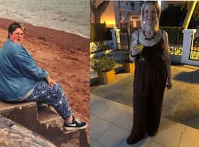 Before and after pictures of Sue Thompson