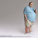 Meet ‘Michael’, a glimpse into humanity’s health 30 years from now if we don’t reduce our Ultra Processed Food (UPF) intake.