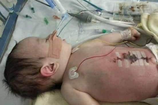Brave Jack has battled for health ever since he was born.