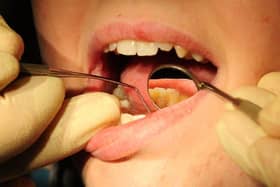 Huge drop in dentist visits