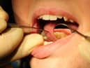 Huge drop in dentist visits