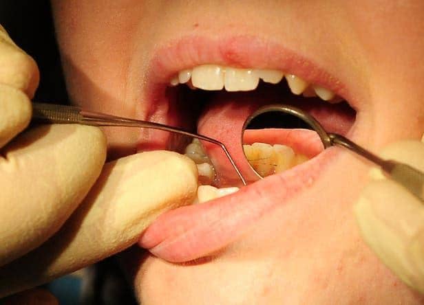 Huge drop in dentist visits