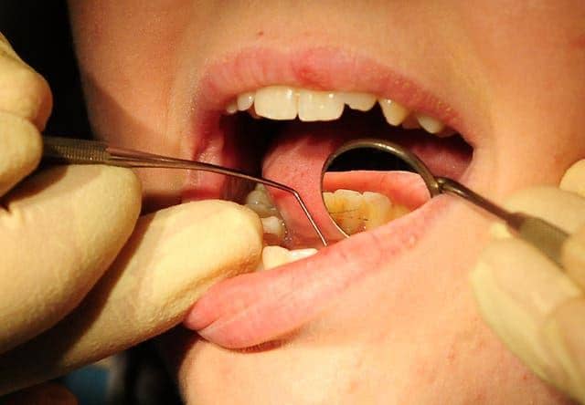 Huge drop in dentist visits