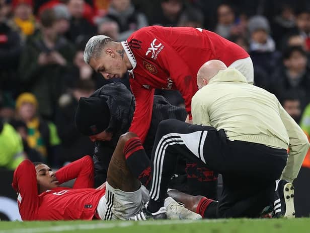Manchester United's Marcus Rashford receives treatment last night.