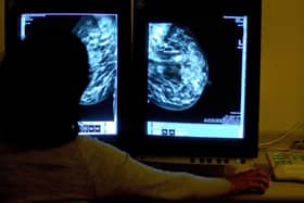 Action call over cancer figures.
