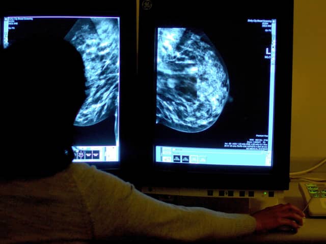 Action call over cancer figures.