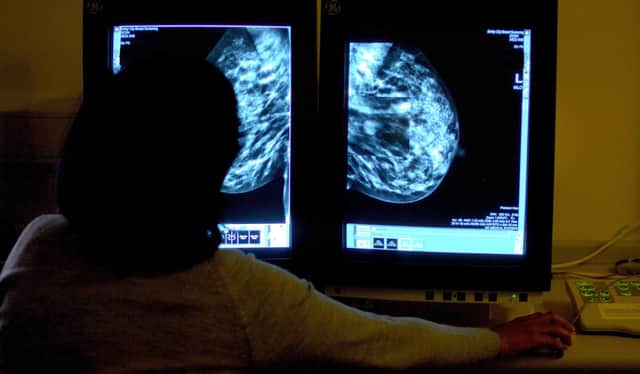 Action call over cancer figures.