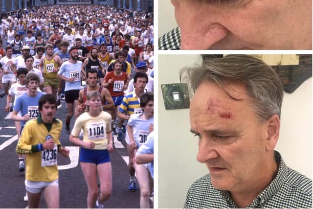 Eamonn Gribben who hopes to find the mystery heroine who came to his aid after suffering a horrific fall on a training run.