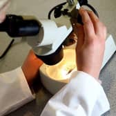 Missed smear tests warning