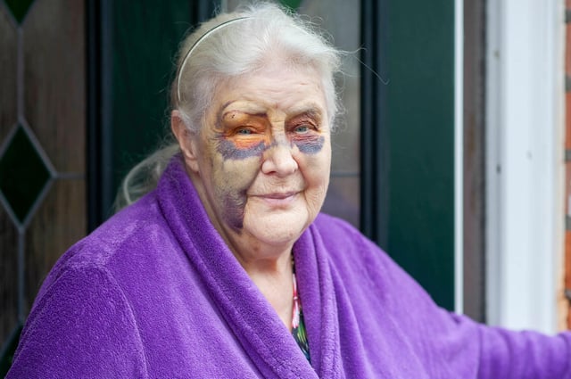 Ida Brown as she heals from the attack