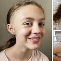 Catrina Anderson, 12, recovering at home after two brain surgeries